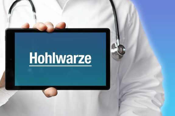 Schlupfwarzen Bad Homburg